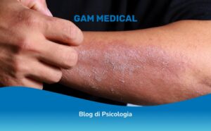 dermatillomania: come si cura