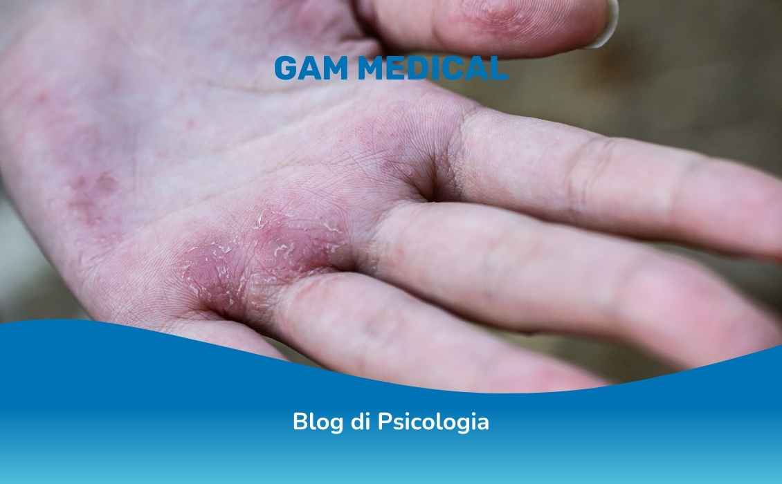 Riconoscere una persona con DOC (disturbo ossessivo compulsivo) dalle sue mani