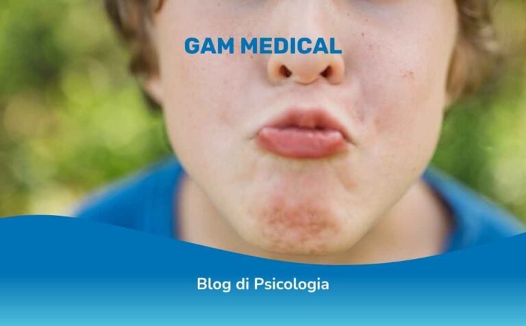 Disprassia bucco-facciale nell'autismo